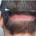 best hair transplant in lahore Profile Picture