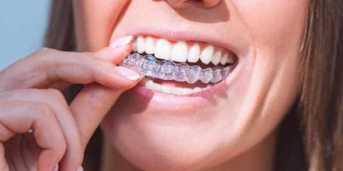Affordable Invisalign Options and Payment Plans in Wolverhampton