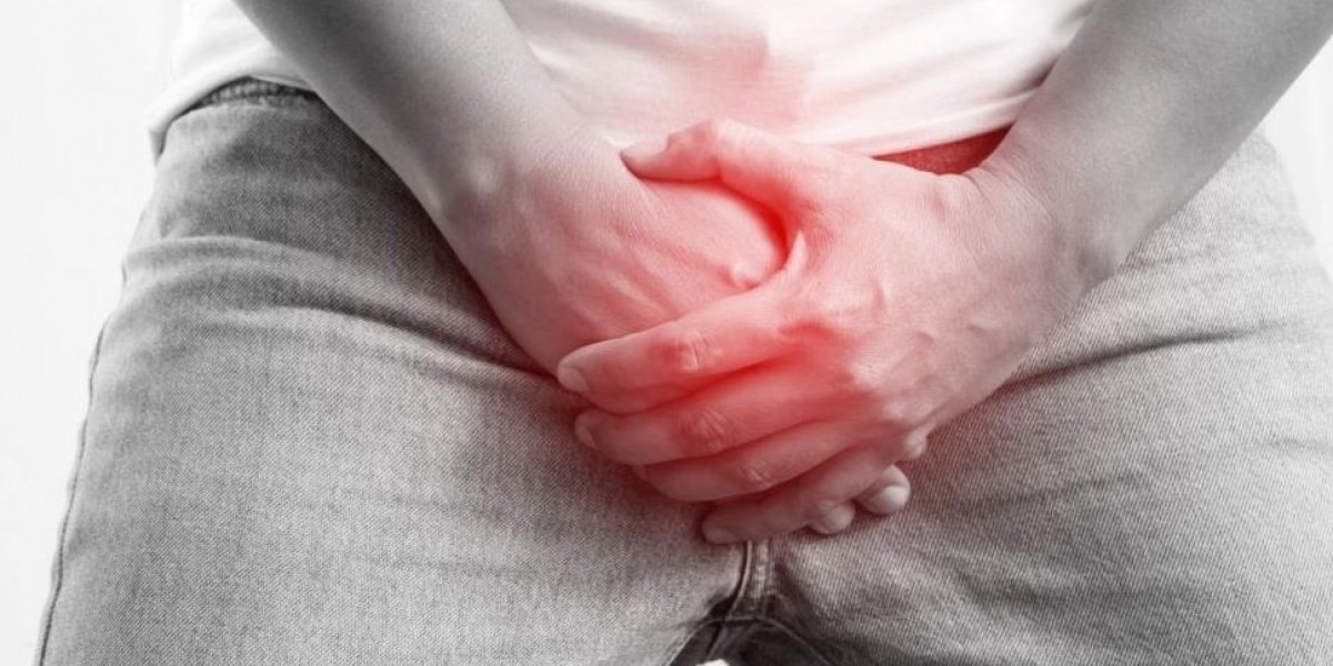 Varicocele Treatment –  Causes, Symptoms, Diagnosis, and Advanced Management